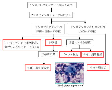 ゴーシェ病 図1 概要、欠損酵素